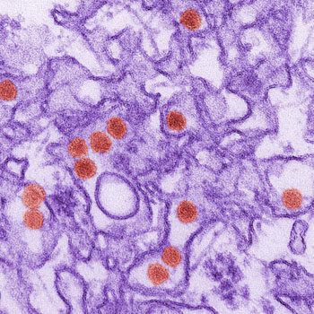 Image: Digitally colorized transmission electron micrograph (TEM) of Zika virus, which is a member of the family Flaviviridae. Virus particles, here colored red, are 40 nanometers in diameter, with an outer envelope, and an inner dense core (Photo courtesy of the CDC).