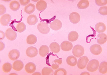 Image: Trypanosoma sp. parasites in blood smear from a patient with African trypanosomiasis (Photo courtesy of the CDC).