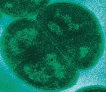 Image: A transmission electron microgragh (TEM) of Deinococcus radiodurans (Photo courtesy of Dr. Michael Daly, Uniformed Services University of the Health Sciences).