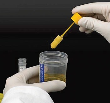 Image: The UriSwab is an advanced system for collection, transport and preservation of urine specimens from the collection site to the testing laboratory (Photo courtesy of Copan).