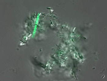 Image: In an innovative new diagnostic test for tuberculosis (TB), a green glow highlights live TB bacteria cells against a field of other debris in a saliva sample (Photo courtesy of Prof. CR Bertozzi, Stanford University).