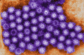 Image: A colored transmission electron micrograph (TEM) of norovirus (Photo courtesy of  Charles D. Humphrey, CDC).