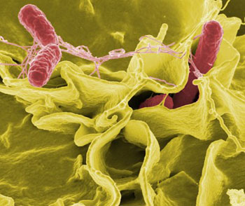 Image: A scanning electron micrograph (SEM) showing Salmonella enterica serotype Typhimurium (red) infecting human cells (yellow) (Photo courtesy of the [U.S.] NIAID Biodefense Image Library).