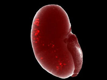 Image: Transplanted long-term cultured nephron progenitor cells (red) are shown being incorporated into a developing kidney (Photo courtesy of the Salk Institute for Biological Studies).