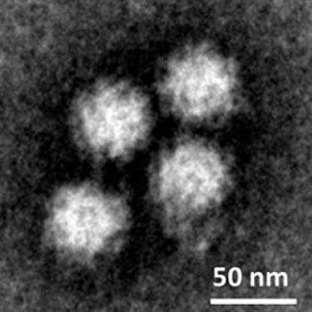 Image: Human norovirus particles released into the supernatant of infected cell cultures were detected with electron microscopy (Photo courtesy of the Estes Laboratory, Baylor College of Medicine).