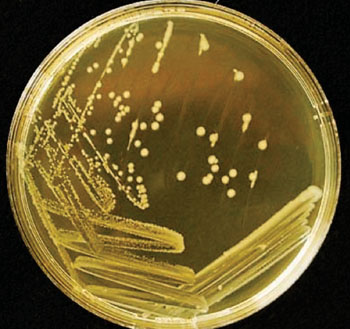 Image: Colonies of Salmonella enterica Serovar Enteritidis streaked on a Luria Agar plate and incubated at 37 ºC for 24 hours (Photo courtesy of Kevin Hedetniemi and Min-Ken Liao).