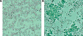 Image: A microscopic appearance of non-aggregate-forming isolates (A) and aggregate-forming isolates (B) of Candida auris in phosphate buffered saline suspensions (Photo courtesy of Public Health England).