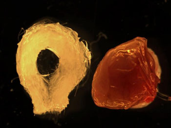 Image: A biodegradable scaffold (left) and human tissue-engineered liver (right) (Photo courtesy of the Saban Research Institute at Children\'s Hospital Los Angeles).