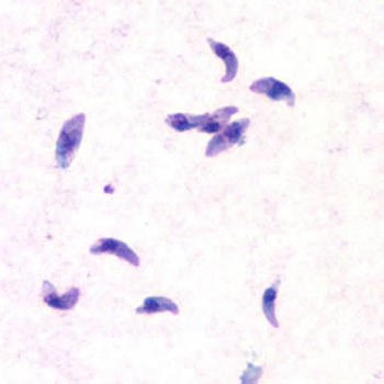 Image: A photomicrograph of Toxoplasma gondii tachyzoites, stained with Giemsa (Photo courtesy of the CDC).