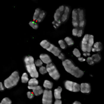 Image: A set of human chromosomes with the \"primary\" and \"backup\" sites for centromere assembly on chromosome 17 painted in red and green, respectively (Photo courtesy of Dr. Elizabeth Sullivan, Duke University).