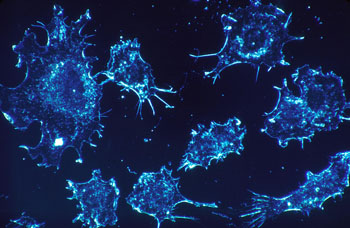 Image: Scientists developed nanoparticles for targeted delivery of chemotherapy. When combined with other cancer treatments, it eradicated tumors in rodents in a recent study (Photo courtesy of Dr. Cecil Fox via Wikimedia Commons).