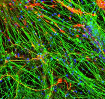 Image: Neuromuscular tissue engineering: hiNSCs (red) grown in co-culture with skeletal muscle (green), with cell nuclei visualized by blue DAPI staining (Photo courtesy of Dr. Dana M. Cairns, Tufts University).