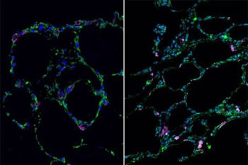 Image: Three-dimensional (3D) bioengineered lung-like tissue (left) resembles adult human lung (right) (Photo courtesy of UCLA).