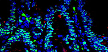 Image: As IBD worsens, levels of the gene regulator EZH2 increase, lowering numbers of protective Paneth cells (Photo courtesy of Sanford Burnham Prebys Medical Discovery Institute).