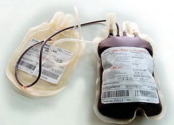 Image: A bag of donor’s blood before cross matching and transfusion (Photo courtesy of the Nursing Times).