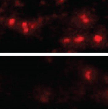 Image: Alpha-synuclein aggregates in the brain cells of mice with (top) and without (bottom) the LAG3 protein (Photo courtesy of Dr. Xiaobo Mao, Johns Hopkins University).