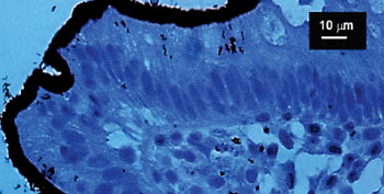 Image: Immunohistochemical detection of human intestinal spirochetosis with signs of invasion (Photo courtesy of the US National Institute of Health).