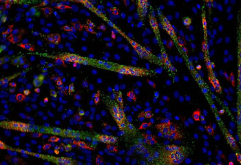 Image: MicroRNA (green) and myogenin mRNA (red) in differentiating C2C12 cells (Photo courtesy of Wikimedia Commons).