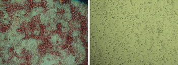 Image: Photomicrographs show that placebo-treated cells (left) have far more lipid (red) production compared to ND-646 treated cells (right) (Photo courtesy of the Salk Institute).