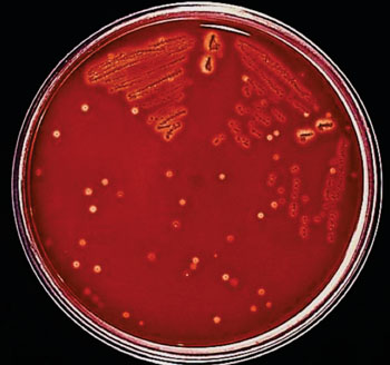 Image: A Petri dish with Group A Streptococcus-inoculated trypticase soy agar containing 5% defibrinated sheep\'s blood (Photo courtesy of Richard R. Facklam, PhD).