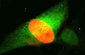 Image: Human CPEB1 protein is shown here in green, while cytomegalovirus (HCMV) is orange (Photo courtesy of the University of California, San Diego).