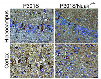 Image: A brain section from mouse carrying the dementia-causing P301S mutation in human tau shows accumulation of tau neurofibrillary tangles (in dark brown, left). When Nuak1 levels are decreased by 50% (P301S/Nuak1+/-; right), fewer tau tangles accumulate (Photo courtesy of the Zoghbi Laboratory, Baylor College of Medicine).
