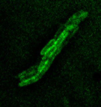 Image: Cytochrome bd-I tagged with Green Fluorescent Protein can be visualized in the membrane of E. coli (Photo courtesy of Dr. Mark Shepherd, University of Kent).