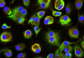 Image: Immunofluorescence staining for PARP9 (red) and PARP14 (green) with nuclei shown in blue (Photo courtesy of Dr. Masanori Aikawa, Brigham and Women\'s Hospital).