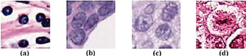 Image: Photomicrographs of a) Lymphocytes, b) Normal epithelial nuclei, c) Cancerous epithelial nuclei, and d) Mitotic nuclei (Photo courtesy of Trinity College Dublin).