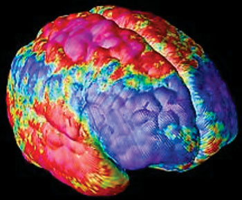 Image: False color image of a brain from a patient with schizophrenia (Photo courtesy of the National Institute of Mental Health).