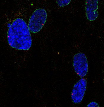 Image: In the image, a super-enhancer driven cell identity gene (red dot) localizes in close proximity to the nuclear envelope (green) in the nucleus of human primary lung fibroblasts (blue) (Photo courtesy of the Salk Institute for Biological Studies).