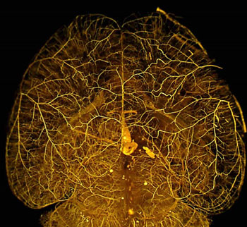 Image: When the mouse gene Rabep2 is deficient, the number and diameter of collateral blood vessels are reduced by 50-60%, and the amount of brain tissue that dies after stroke is more than doubled. The human version of Rabep2 is likely to have a comparable function (Image courtesy of the Faber Lab, University of North Carolina School of Medicine).