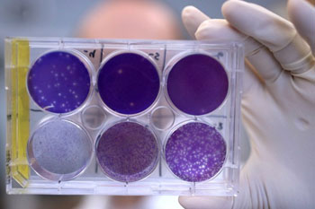 Image: A researcher holds a tray of Zika virus growing in animal cells. Researchers have identified a human antibody that prevents, in pregnant mice, the fetus from becoming infected and the placenta from being damaged (Photo courtesy of Huy Mach, Washington University School of Medicine).