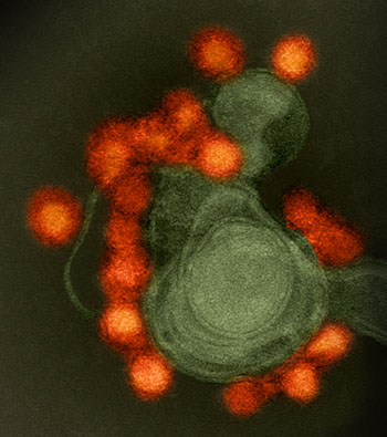 На изображении, полученном с помощью трансмиссионного электронного микроскопа, показан штамм вируса Зика, зарегистрированный в г.Форталеза (красный), выделенный в случае заболевания микроцефалией (фото любезно предоставлено Национальным институтом аллергии и инфекционных заболеваний).