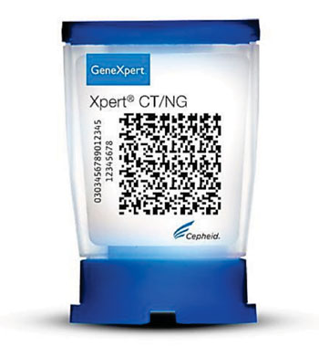 Image: The GeneXpert CT/NG rapid diagnostic test cartridge (Photo courtesy of Cepheid).