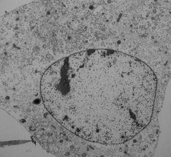 Image: A fibroblast undergoing ferroptosis (Photo courtesy of Helmholtz Zentrum München).
