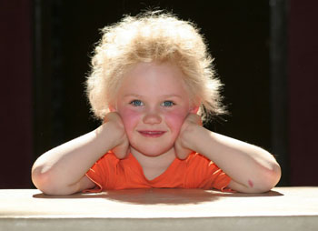 Image: A girl with uncombable hair syndrome (Photo courtesy of the University of Bonn).