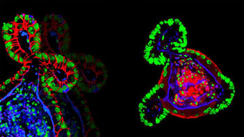 Image: Two fluorescent microscopy images of intestinal organoids growing in synthetic hydrogels (Photo courtesy of N. Gjorevski, Ecole Polytechnique Fédérale de Lausanne).