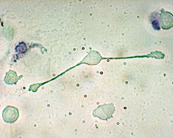 Image: A photomicrograph of a mouse macrophage of extending pseudopodia to engulf two particles, possibly pathogens (Photo courtesy of Wikimedia Commons).