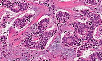 Image: These estrogen receptor-positive (ER+) breast cancer cells preserved epigenomic determinants that may be prognostic for cancer survival (Photo courtesy of the National Cancer Institute).