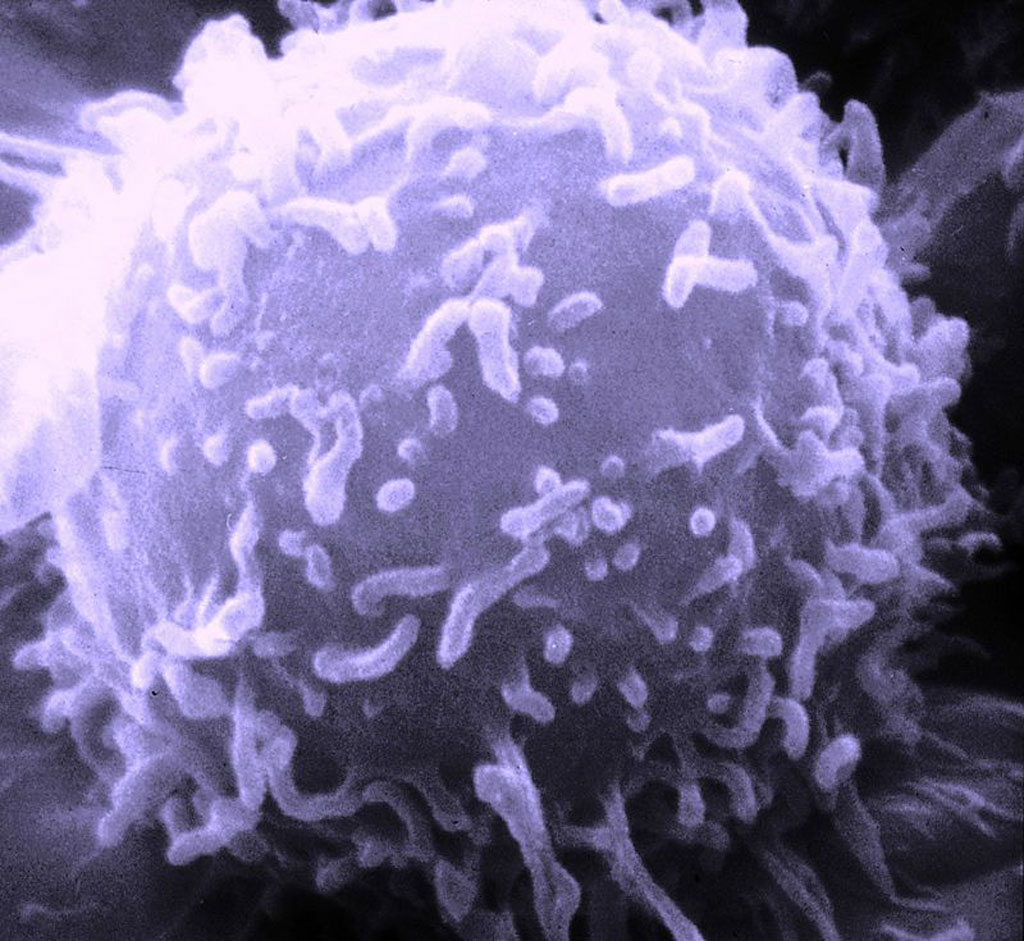 Image: A scanning electron microscopic (SEM) image of a single human lymphocyte (Photo courtesy of Wikimedia Commons).