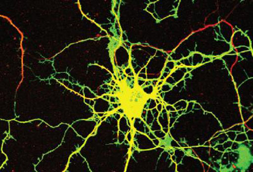 Image: A neuron in culture was transduced with a virus that expresses a green fluorescent protein and an inhibitory RNA that causes loss of the DENND5A protein. The neurons where then stained with a marker of neuronal processes in red (Photo courtesy of Peter McPherson Laboratory, Montreal Neurological Institute, McGill University).