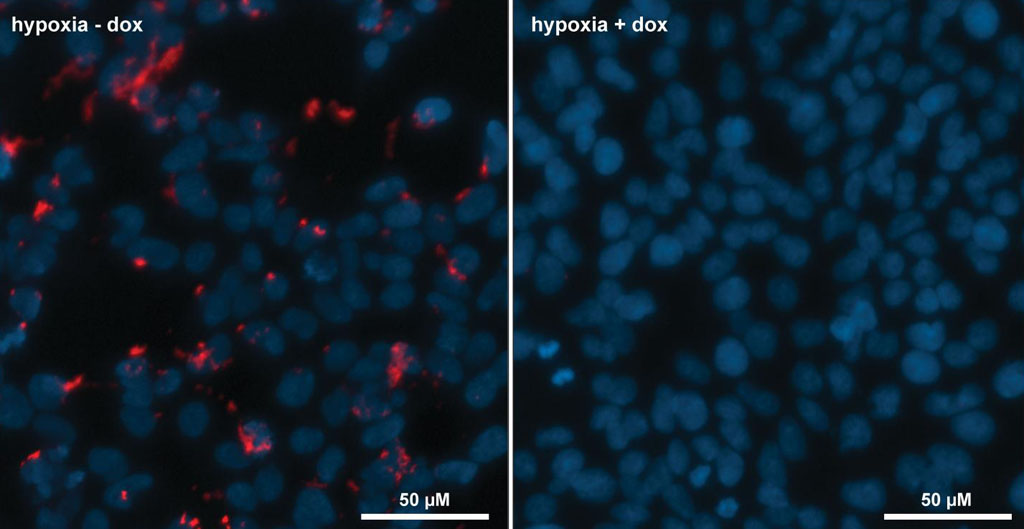 Image: Photomicrographs of the engineered cells (nuclei in blue) with HIF-1 visualized (in red). In the left hand panel, cells are in hypoxia but no doxycycline is present, therefore HIF-1 remains active (red dots). In the right hand panel, the cells are grown in hypoxia and in the presence of doxycycline, therefore the cyclic peptide inhibitor is produced and HIF-1 is inhibited, as demonstrated by the absence of the red dots (Photo courtesy of the University of Southampton).