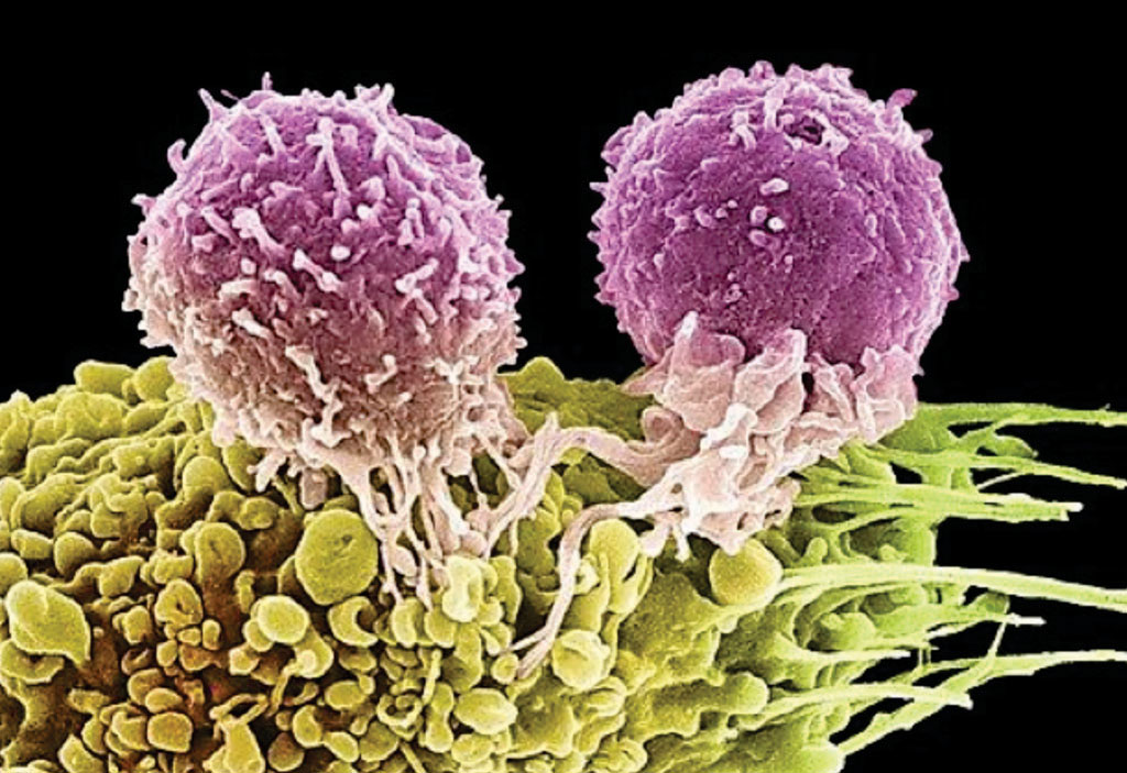 Image: A colored scanning electron micrograph (SEM) of two T lymphocyte cells attached to a cancer cell (Photo courtesy of the National Institute of Health).