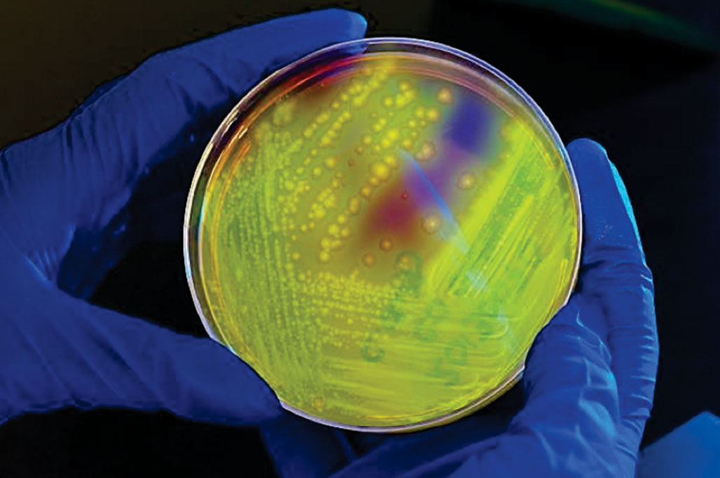 Image: A Petri dish culture plate that contains Cycloserine Cefoxitin Fructose Agar (CCFA), which had been inoculated with a Clostridium difficile bacterial culture. The plate had been illuminated using long-wave UV irradiation, hence, the bacterial colonies emitted a yellow-green, or chartreuse fluorescent glow (Photo courtesy of James Gathany).