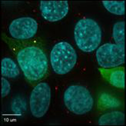 Image: Human kidney cells stained with a P-body marker (red) and NoBody (green). Yellow dots are where P-bodies and NoBody interact. Cell nuclei are shown in blue (Photo courtesy of Yale University).