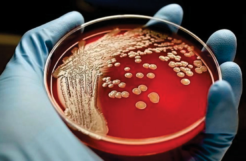 Image: Bacterial colonies of Staphylococcus aureus growing on horse blood agar (Photo courtesy of OMICS International).