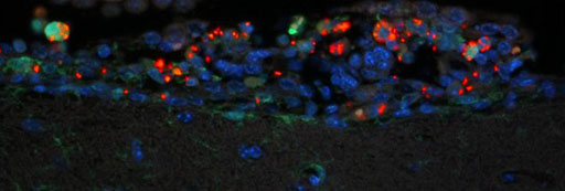 Image: A fluorescent micrograph showing detection of Salmonella (red) in macrophages (green) and other immune cells in the ventricles of the brain of a mouse orally fed Salmonella. Salmonella-infected areas were associated with an increase of cells (blue nucleus) in the ventricles and meninges of the brain, a hallmark of bacterial meningitis (Photo courtesy of the [U.S.] National Institute of Allergy and Infectious Diseases).