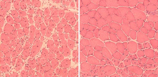 Image: Induction of reprogramming improved muscle regeneration in aged mice. (Left) impaired muscle repair in aged mice; (right) improved muscle regeneration in aged mice subjected to reprogramming (Photo courtesy of the Salk Institute for Biological Studies).