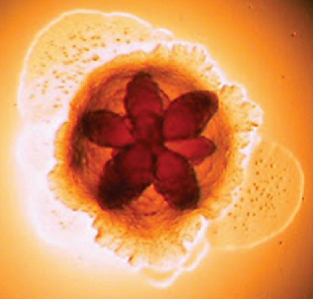 Image: A colony of Aggregatibacter actinomycetemcomitans, showing the characteristic flower-like morphology (Photo courtesy of UCL Eastman Dental Institute).